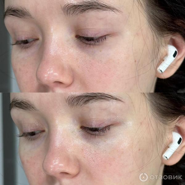 Крем для контура глаз La Roche - Posay Tolerian Dermallergo yeux фото
