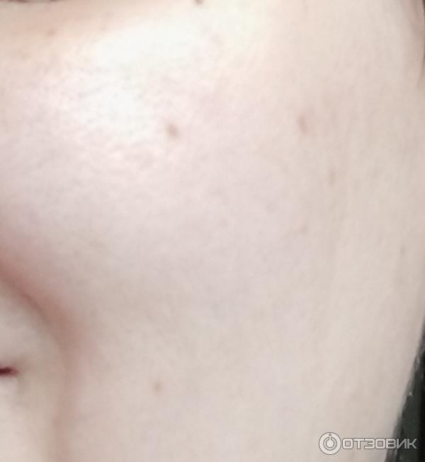 Гиалуроновая сыворотка-филлер Vichy Liftactiv Supreme