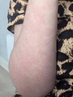 Лекарственный препарат АВВА РУС Лактофильтрум фото