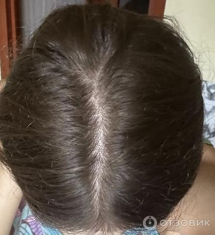 Лосьон от выпадения волос Charismo Dekopill фото