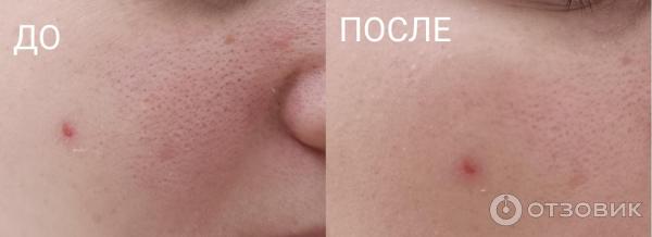 Пудра The Saem perfect pore pink pact фото