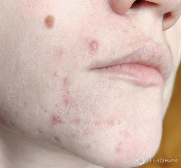 Очищающий гель для умывания La Roche-Posay Effaclar для жирной и чувствительной кожи фото