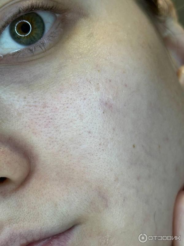 Гиалуроновая сыворотка-филлер пролонгированного действия Liftactiv Supreme. Бренд Vichy.