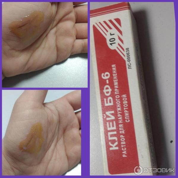 Отзыв о Клей медицинский БФ-6 Верба-Фарм | Не нашла ни одного недостатка