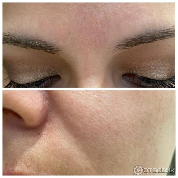 ДО применения сыворотки-филлера от Vichy Liftactive Supreme