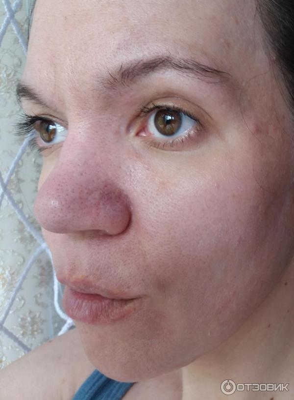 Гиалуроновая сыворотка-филлер Vichy Liftactiv Supreme фото