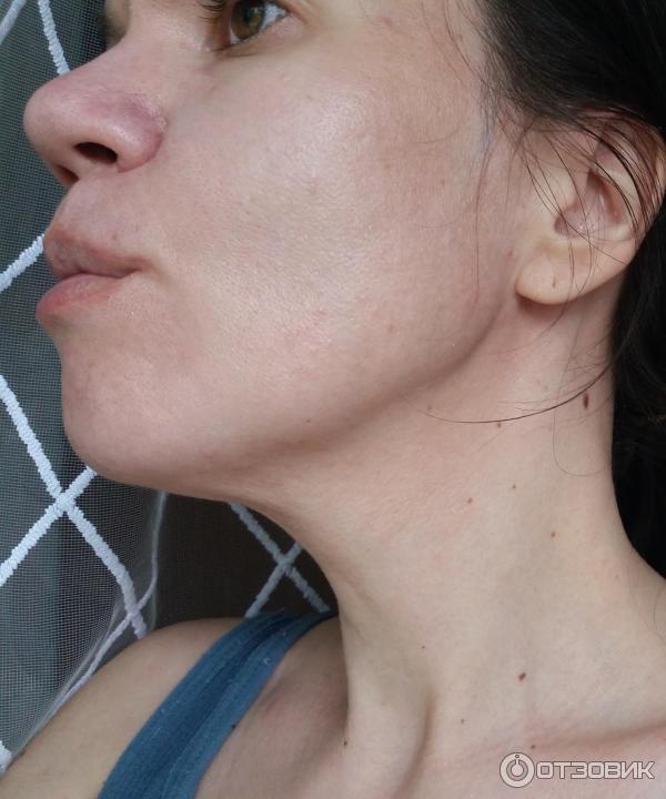 Гиалуроновая сыворотка-филлер Vichy Liftactiv Supreme фото