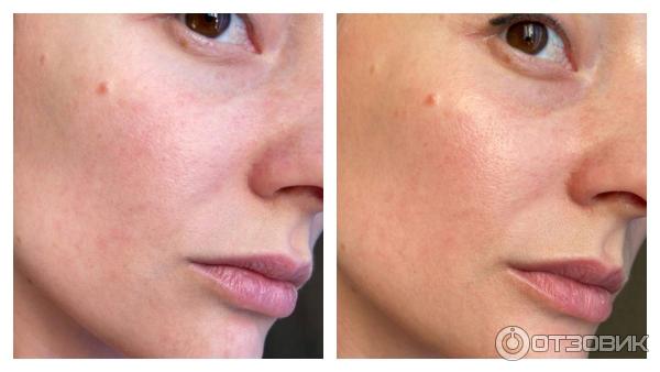 Гиалуроновая сыворотка-филлер Vichy Liftactiv Supreme фото