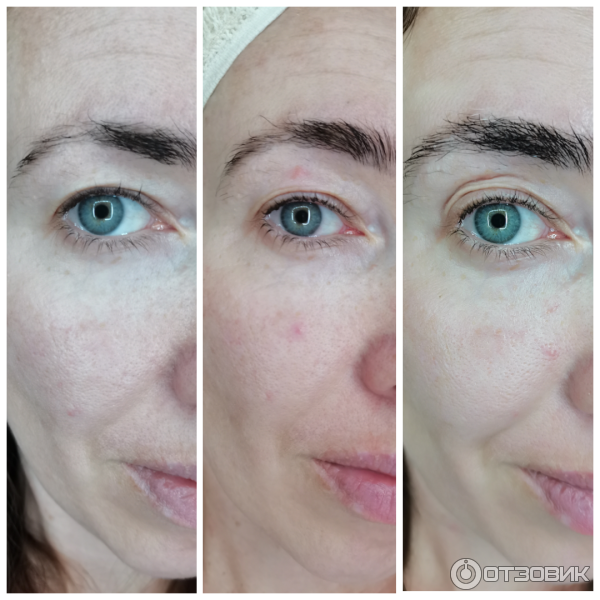 Сыворотка для роста бровей и ресниц TopLash Lash and Brow Booster фото