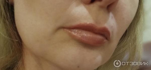 Ощущение жжения губы. Ощущение жжения губы