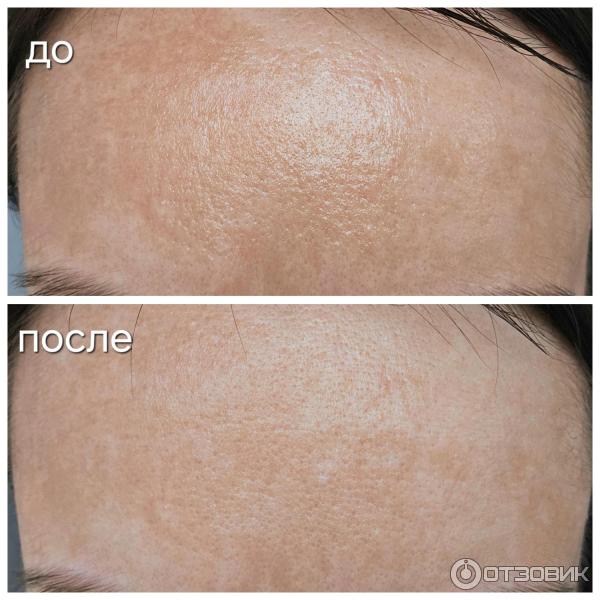 Очищающий гель для умывания La Roche-Posay Effaclar для жирной и чувствительной кожи фото