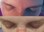 Средство для роста ресниц Carelash фото