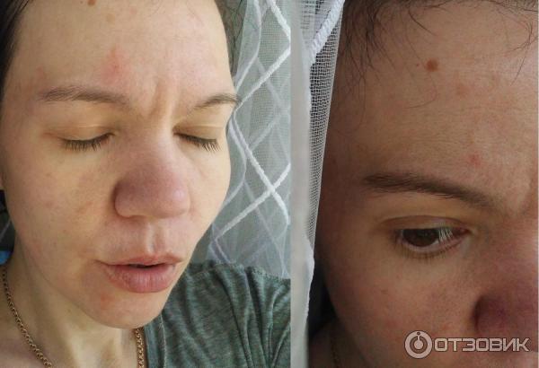 Очищающий гель для умывания La Roche-Posay Effaclar для жирной и чувствительной кожи фото