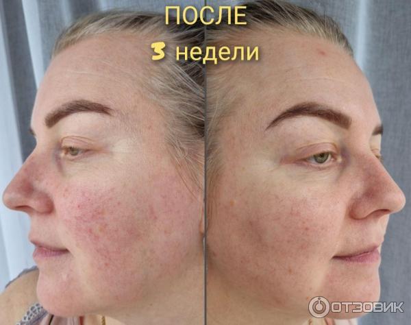 Сыворотка La Roche-Posay Toleriane Ultra Dermallergo